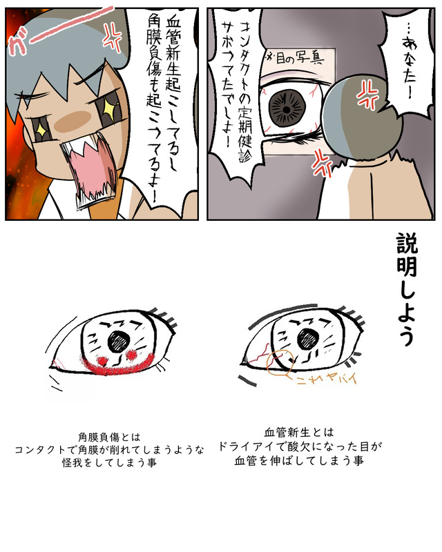角膜負傷と血管新生|不健康日記